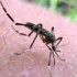 Бабин лек против каснување од комарец или друг инсект