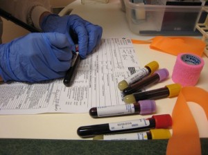 krv analiza test