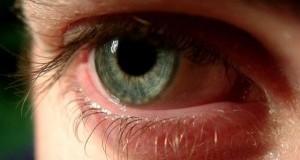 Внимавајте – секојдневно пациенти со инфекција на очи