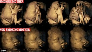 fetus-majka-pusac-01
