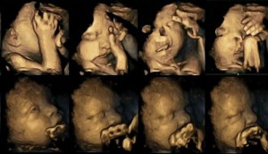 fetus-majka-pusac-02