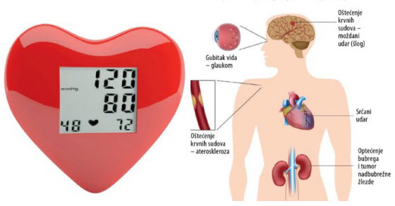 nizak mozdani pritisak oticanje hipertenzije