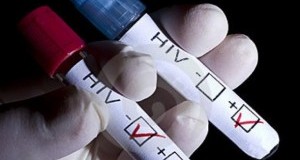 Ден на борбата против сида: Ако ги имате овие симптоми, можеби сте заразени со ХИВ вирусот