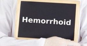 Домашни лекови за хемороиди