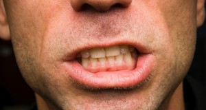 Бруксизам – Шкрипење со забите
