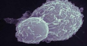 Работите кои можат да предизвикаат рак – а не сте ни свесни дека се канцерогени