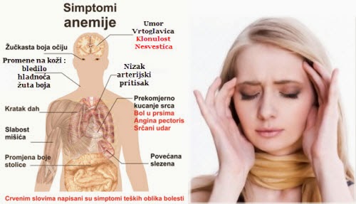 anemija_simptomi