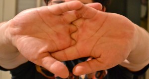 Крцкањето на прстите остава последици: Еве што се случува со телото
