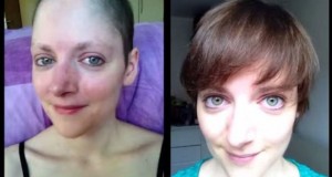 Видео: Оваа девојка го победи ракот- Еве за колку време и порасна коса