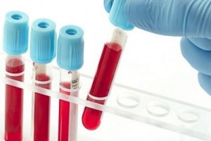 detaljne-analize-krv