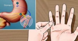 Едноставен тест со прстите – за помалку од една минута дознајте дали ви се заканува дијабетис