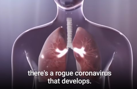 Што му прави коронавирусот на телото – орган по орган